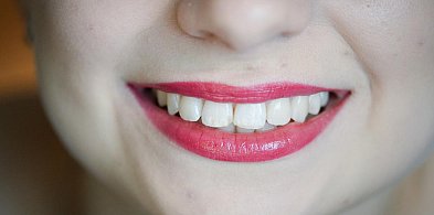 UOKiK: prawie 3,5 mln zł kary dla Dr Smile za sposób zawierania umów z konsumentam-18314